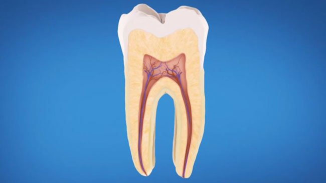 endodontic treatment